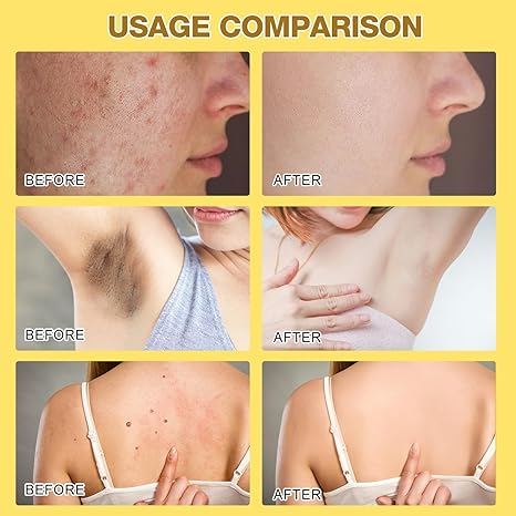 Professional Bee Venom Repair Cream, For All Body Parts