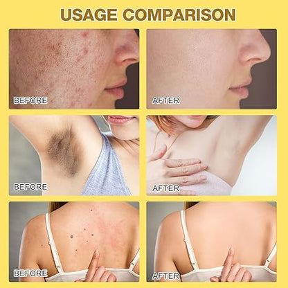 Professional Bee Venom Repair Cream, For All Body Parts