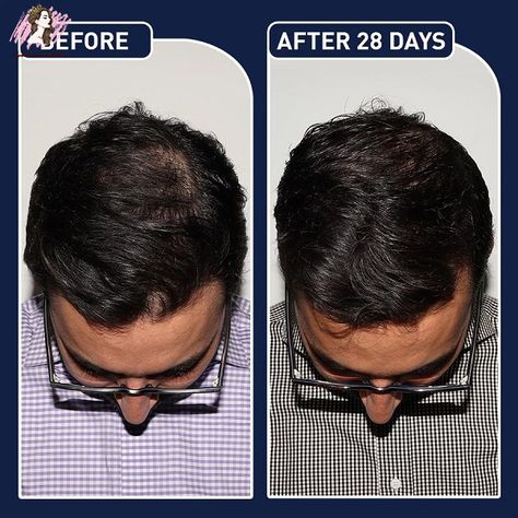 FEG Plus Hair Growth Spray